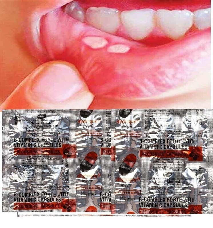 BECOSULES CAPSULES BICASULE Vitamin B-complex Help For Sore Tongue And Mouth.